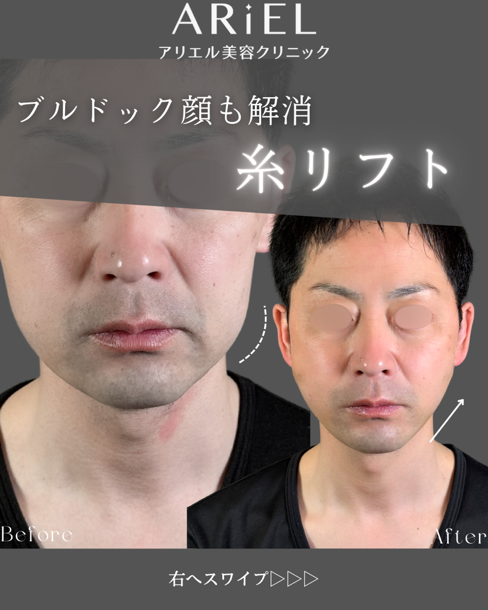 No.8873の症例写真